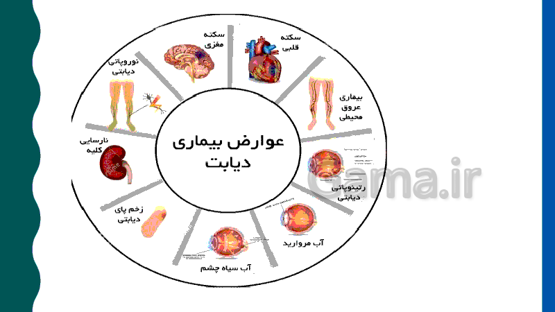 پاورپوینت بیماری دیابت، علائم و راه های درمان آن- پیش نمایش