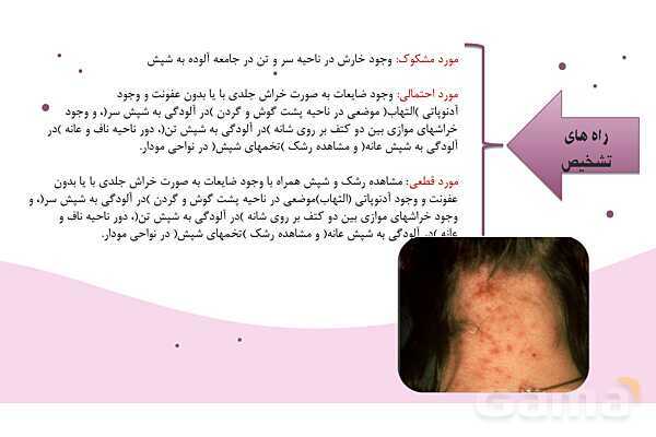 پاورپوینت واحد سلامت، بهداشت و صیانت از محیط زیست (بیماریهای واگیر دار)- پیش نمایش