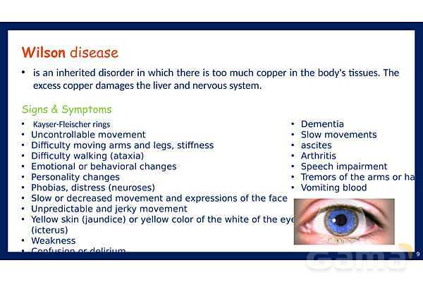 پاورپوینت بیماری‌های متابولیک مرتبط با ویتامین‌ها و کوفاکتورها (Metabolic diseases of Cofactors and vitamins PPTX)- پیش نمایش